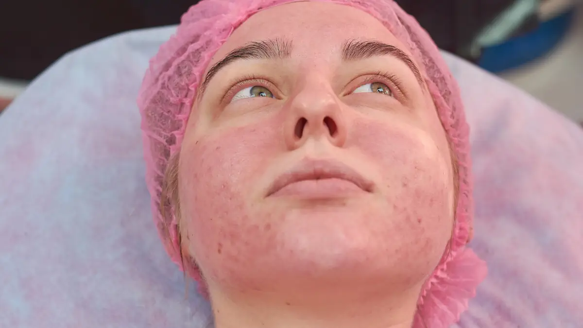 Anti-Inflammatory Solution To Soothe and Heal Your Skin