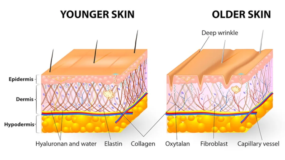 Younger skin - Older skin